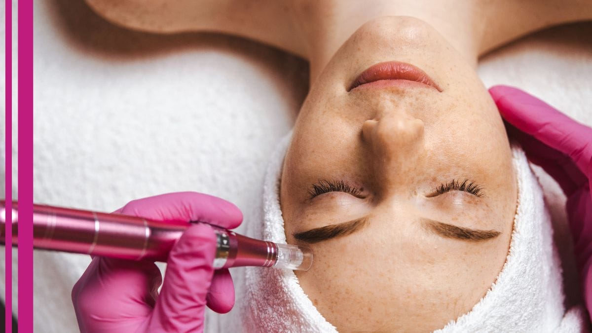 A client gets a microneedlng session done, one of the best anti aging treatments.