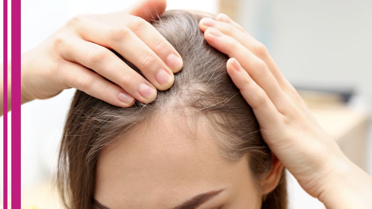 A client shows her beauty pro her hair loss and asks her if hair loss is a sign of menopause?